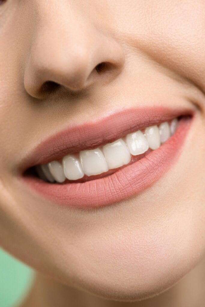 Sorriso com dentes brancos e saudáveis representando sonhos positivos com dentes